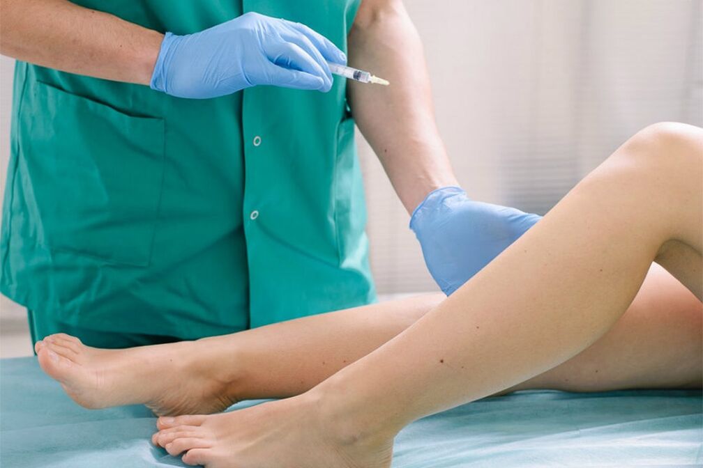 barizeak kentzeko eskleroterapia